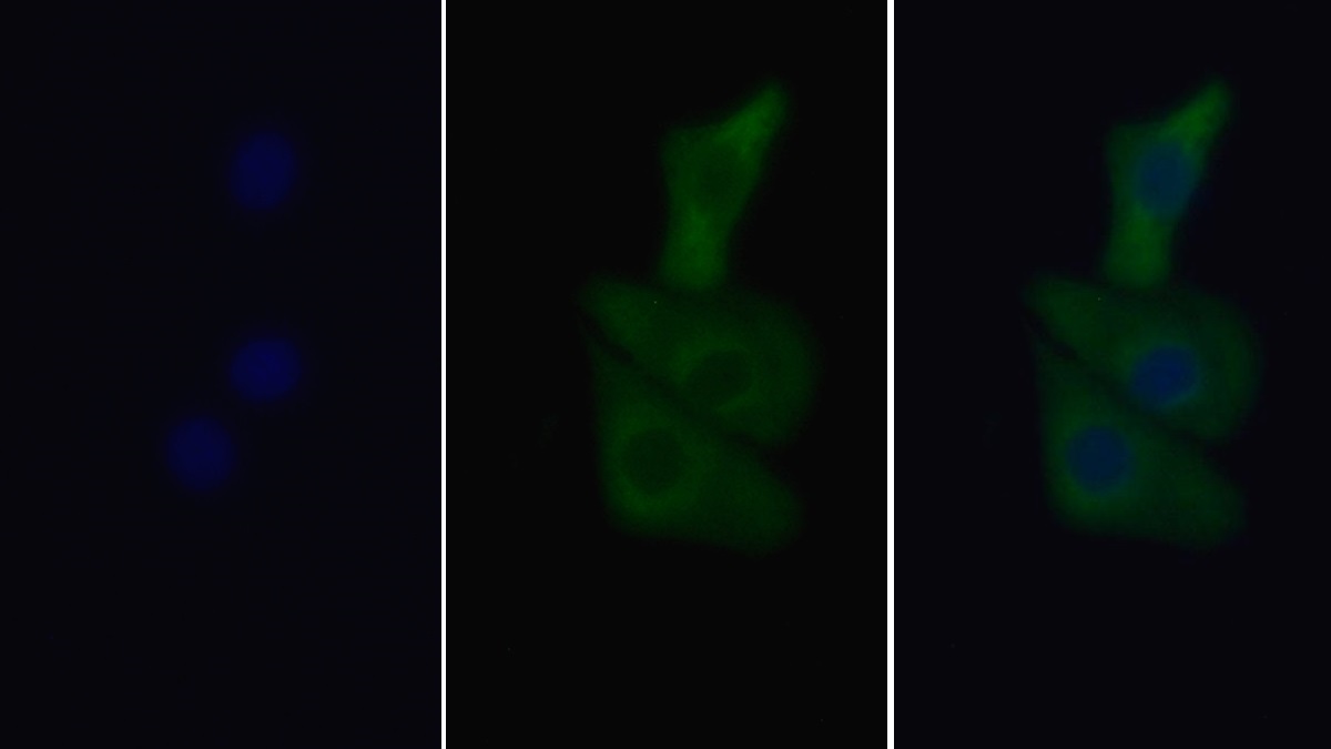 Monoclonal Antibody to Sequestosome 1 (SQSTM1)