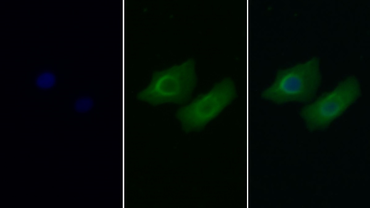 Monoclonal Antibody to Sequestosome 1 (SQSTM1)