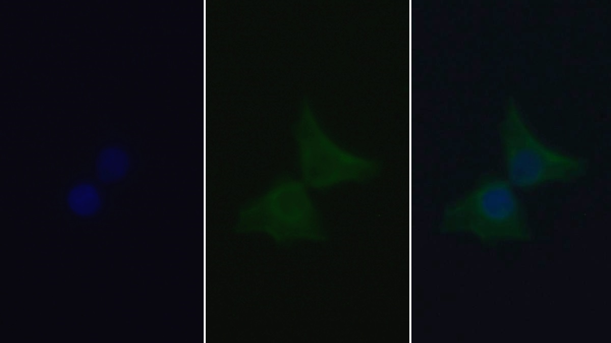 Monoclonal Antibody to Sequestosome 1 (SQSTM1)