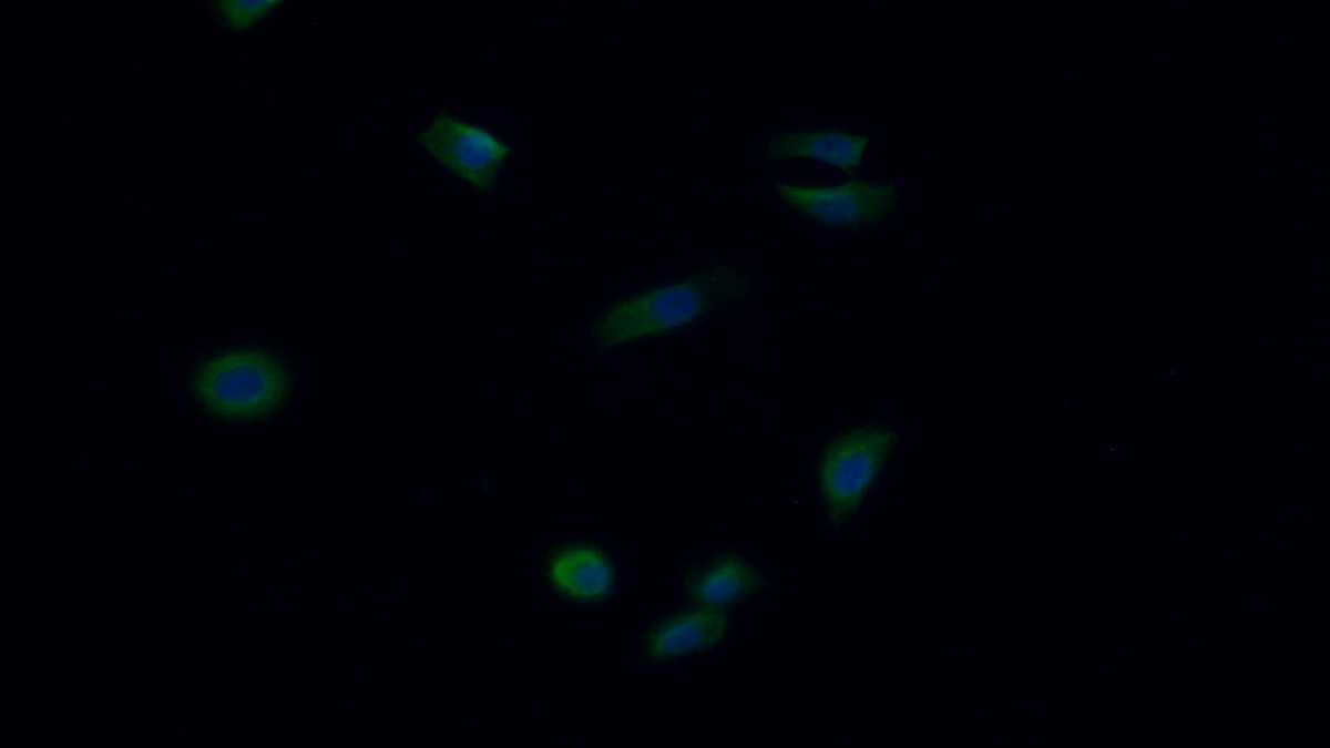 Monoclonal Antibody to Sequestosome 1 (SQSTM1)