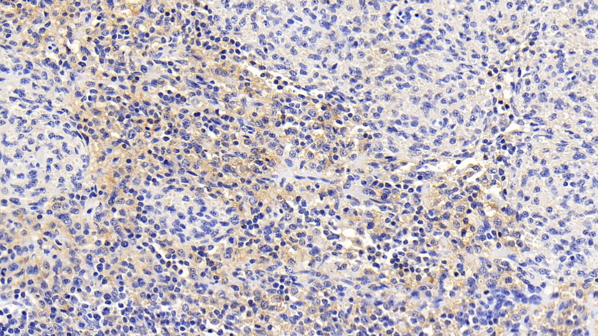 Monoclonal Antibody to Sequestosome 1 (SQSTM1)