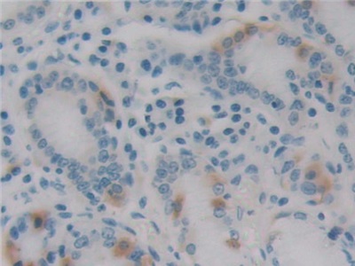 Monoclonal Antibody to Epstein Barr Virus Induced Protein 3 (EBI3)