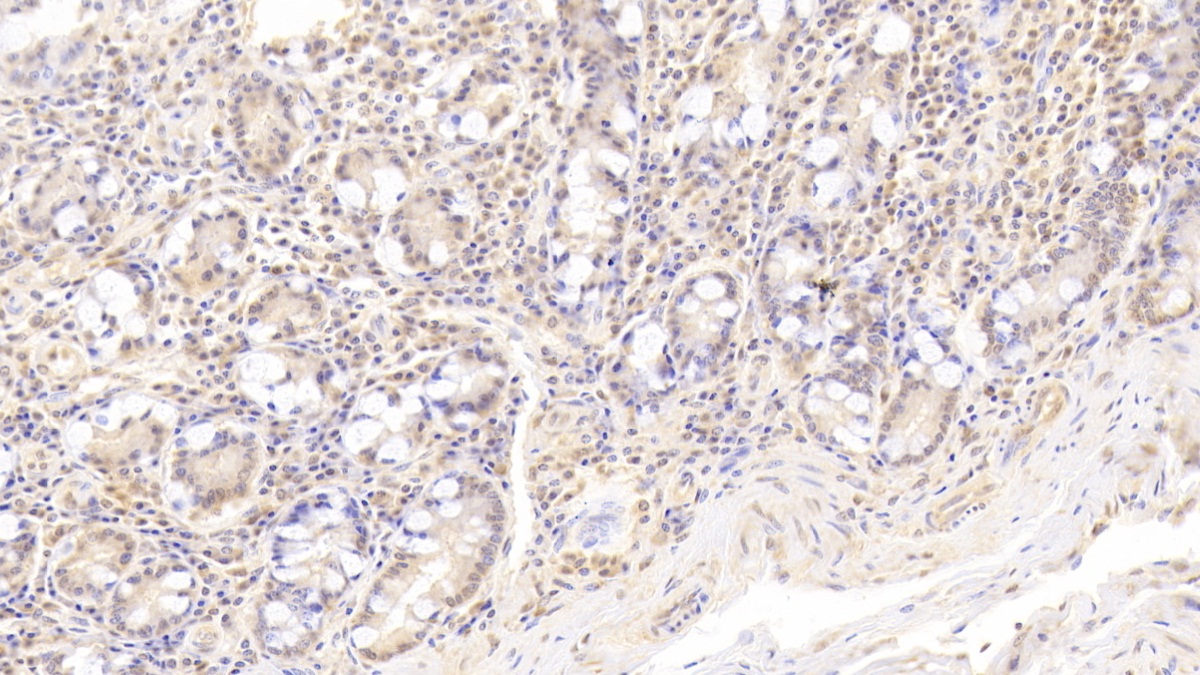 Monoclonal Antibody to Lipase, Monoacylglycerol (MGL)