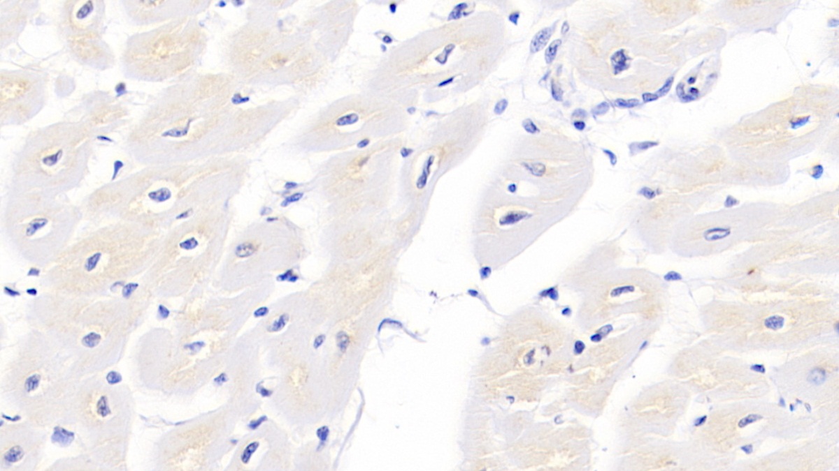 Monoclonal Antibody to Troponin T Type 2, Cardiac (TNNT2)