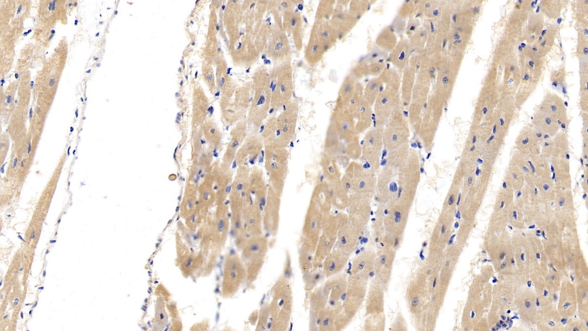 Monoclonal Antibody to Troponin T Type 2, Cardiac (TNNT2)