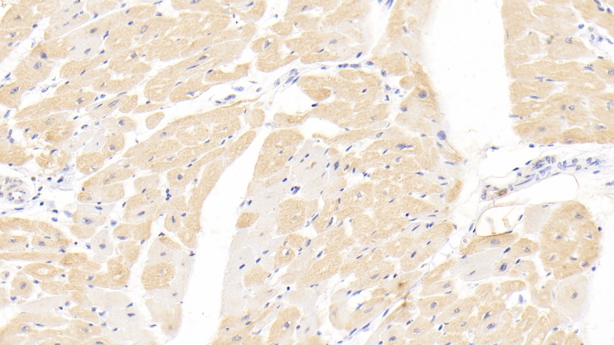 Monoclonal Antibody to Troponin T Type 2, Cardiac (TNNT2)