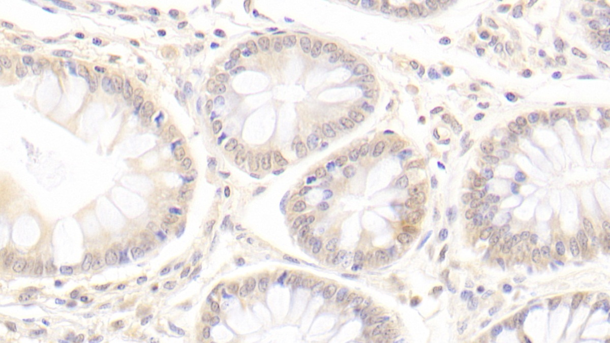 Monoclonal Antibody to Amiloride Sensitive Sodium Channel Subunit Gamma (SCNN1g)