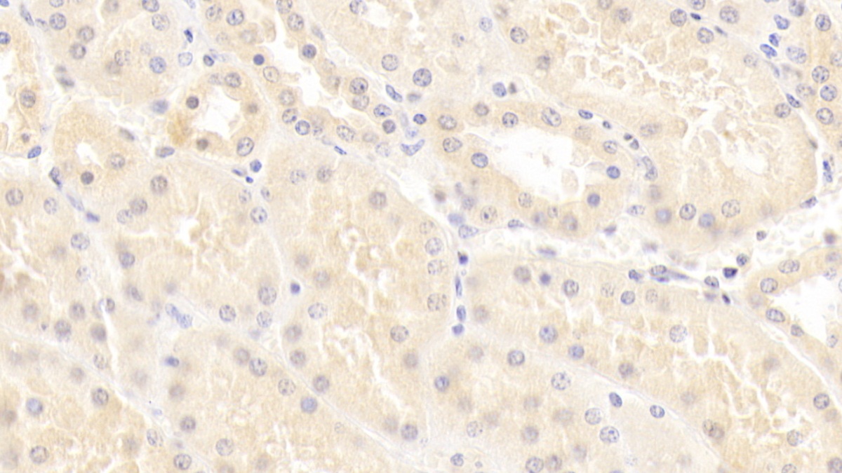 Monoclonal Antibody to Amiloride Sensitive Sodium Channel Subunit Gamma (SCNN1g)