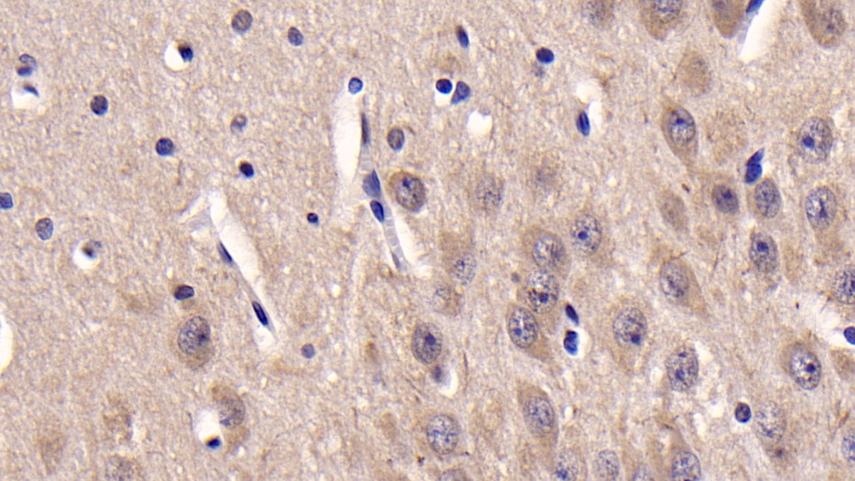 Monoclonal Antibody to Casein Kinase 1 Delta (CSNK1d)