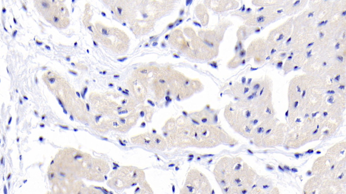 Monoclonal Antibody to Myosin Heavy Chain 7, Cardiac Muscle, Beta (MYH7)