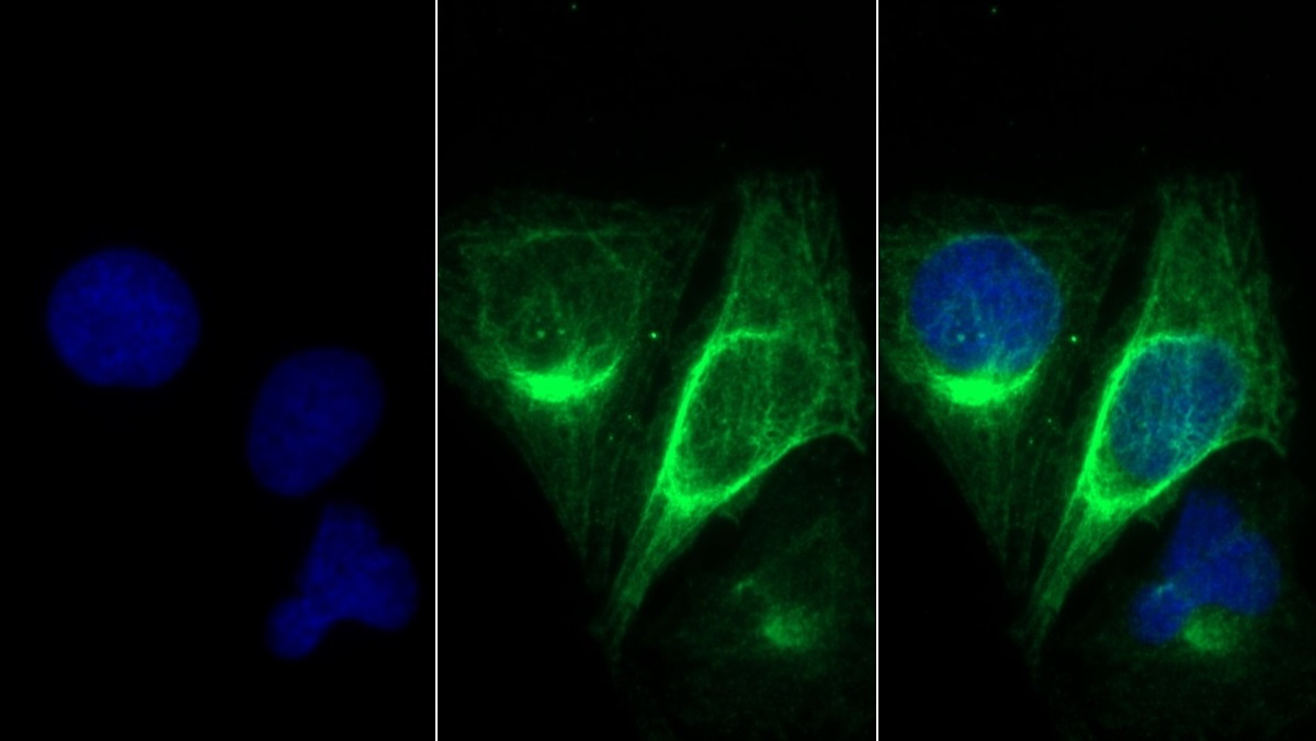 Monoclonal Antibody to Myosin Heavy Chain 8, Skeletal Muscle, Perinatal (MYH8)