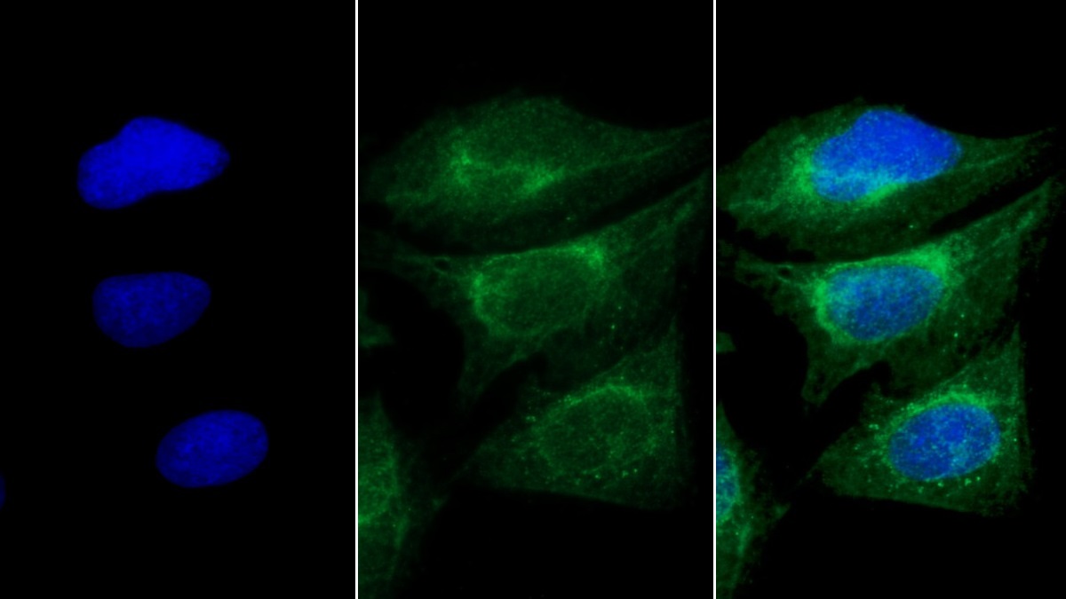 Monoclonal Antibody to Myosin Heavy Chain 8, Skeletal Muscle, Perinatal (MYH8)