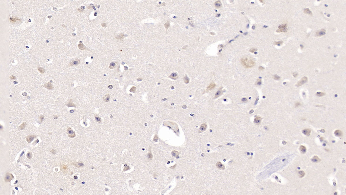 Monoclonal Antibody to Apolipoprotein L2 (APOL2)