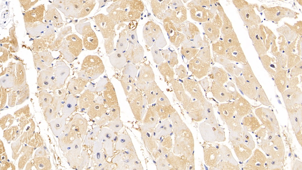 Monoclonal Antibody to Lipolysis Stimulated Lipoprotein Receptor (LSR)