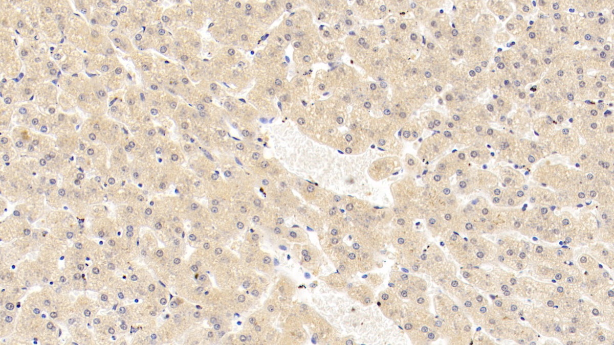 Monoclonal Antibody to Lipolysis Stimulated Lipoprotein Receptor (LSR)