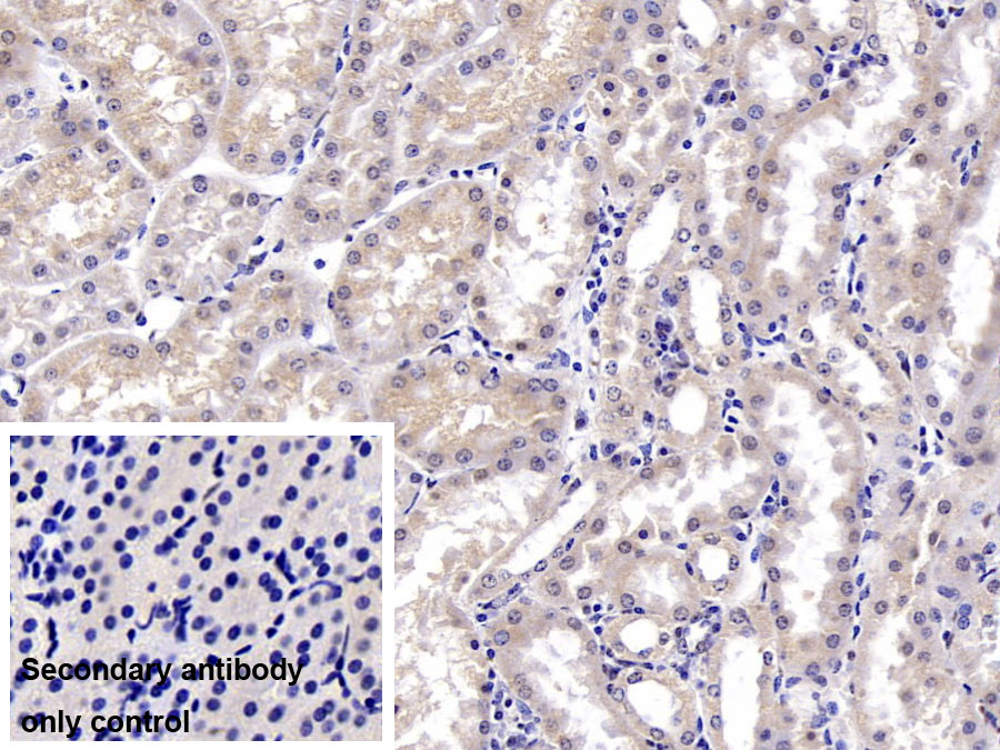 Monoclonal Antibody to Deoxythymidylate Kinase (DTYMK)