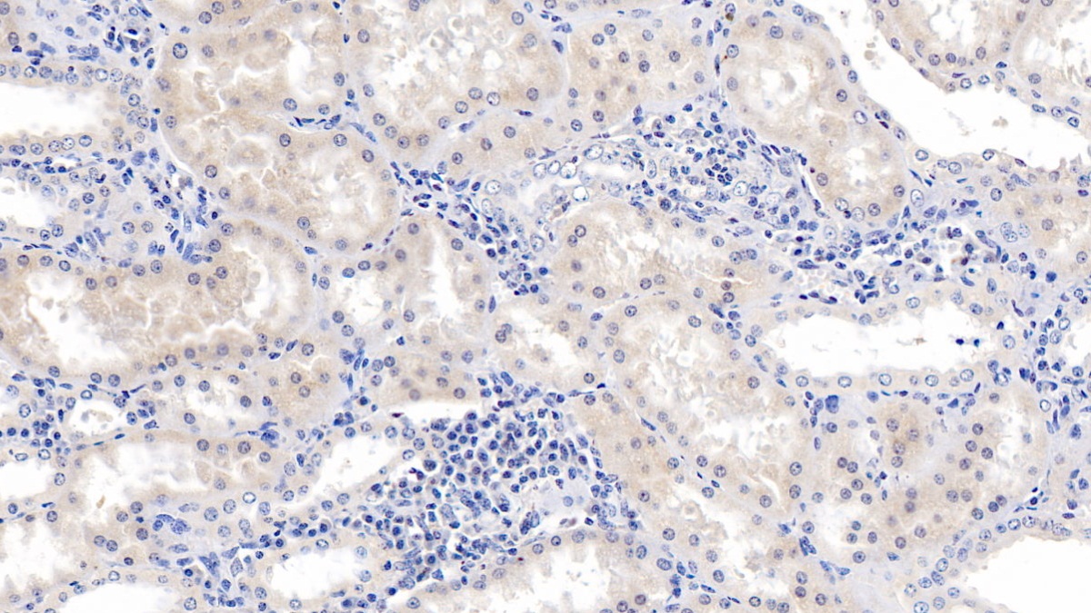 Monoclonal Antibody to Arginase II (Arg2)