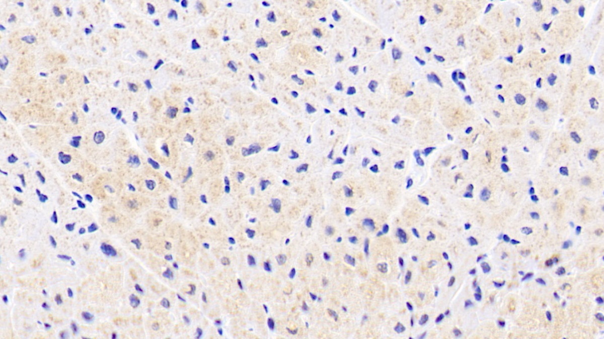 Monoclonal Antibody to Aspartate Aminotransferase 2 (AST2)