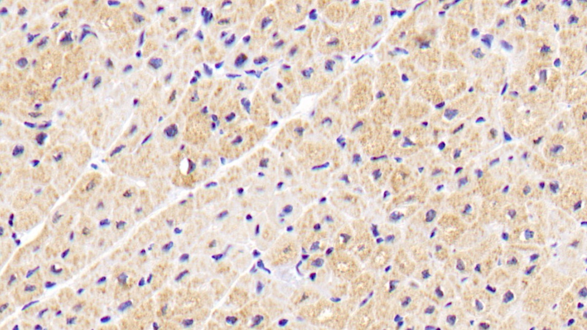 Monoclonal Antibody to Aspartate Aminotransferase 2 (AST2)