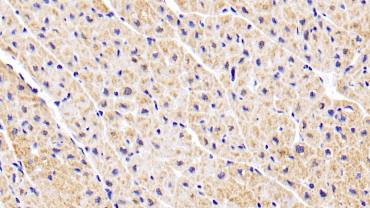 Monoclonal Antibody to Aspartate Aminotransferase 2 (AST2)