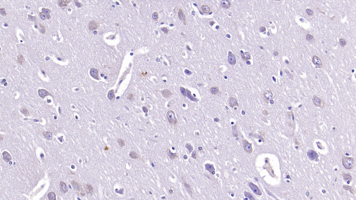 Monoclonal Antibody to Sialic Acid Binding Ig Like Lectin 10 (SIGLEC10)