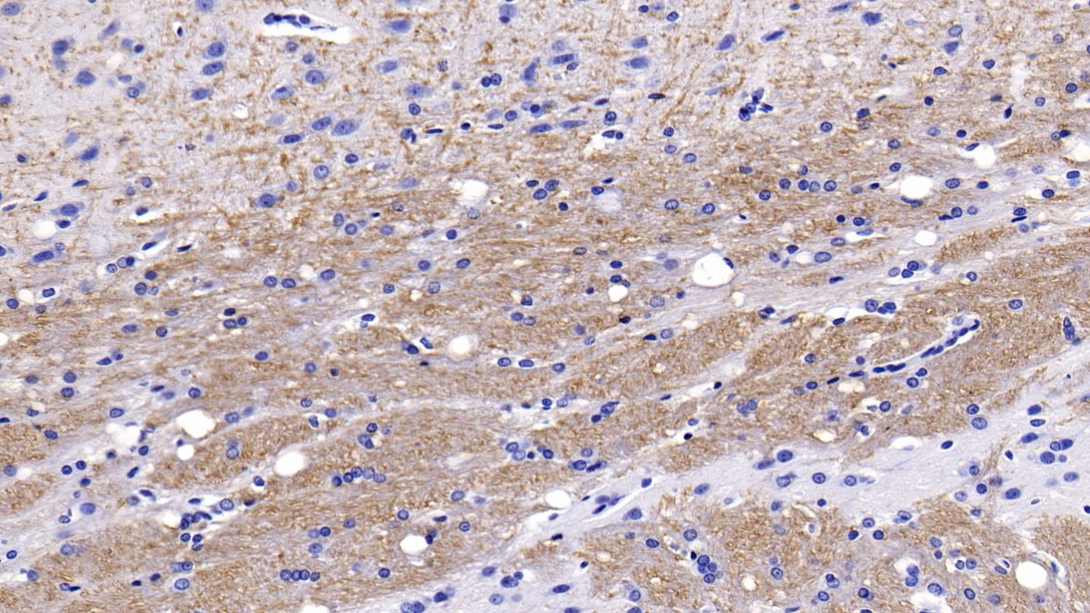 Monoclonal Antibody to Neurofilament, Light Polypeptide (NEFL)