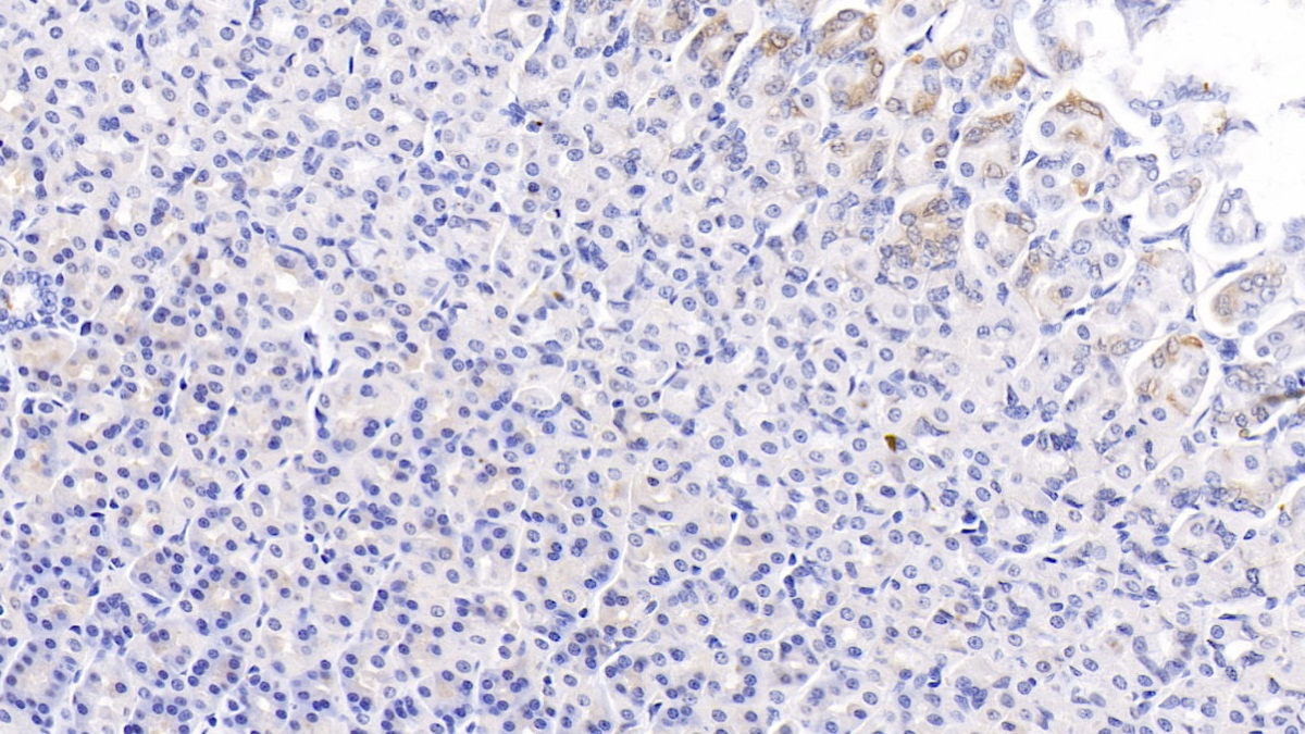 Monoclonal Antibody to Proprotein Convertase Subtilisin/Kexin Type 9 (PCSK9)