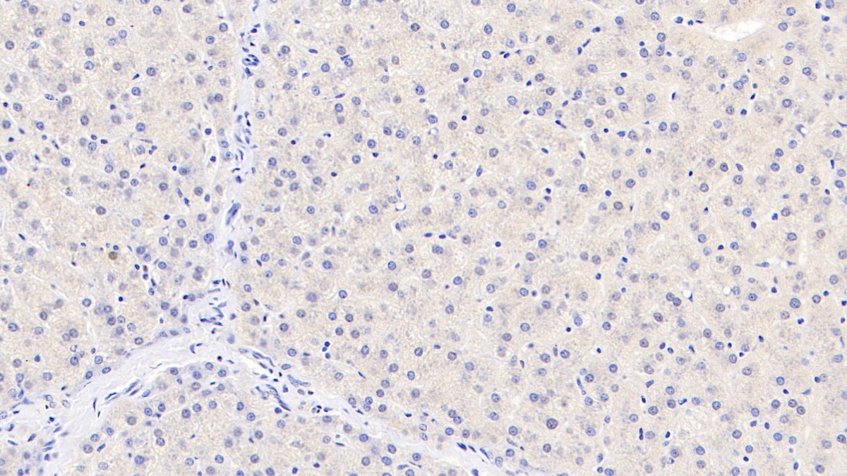 Monoclonal Antibody to Tryptophan-2,3-dioxygenase (TDO)