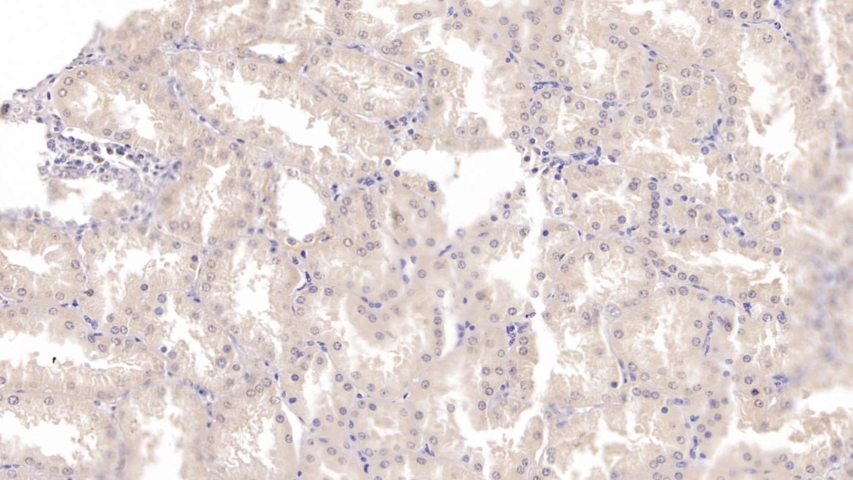 Monoclonal Antibody to Tryptophan-2,3-dioxygenase (TDO)