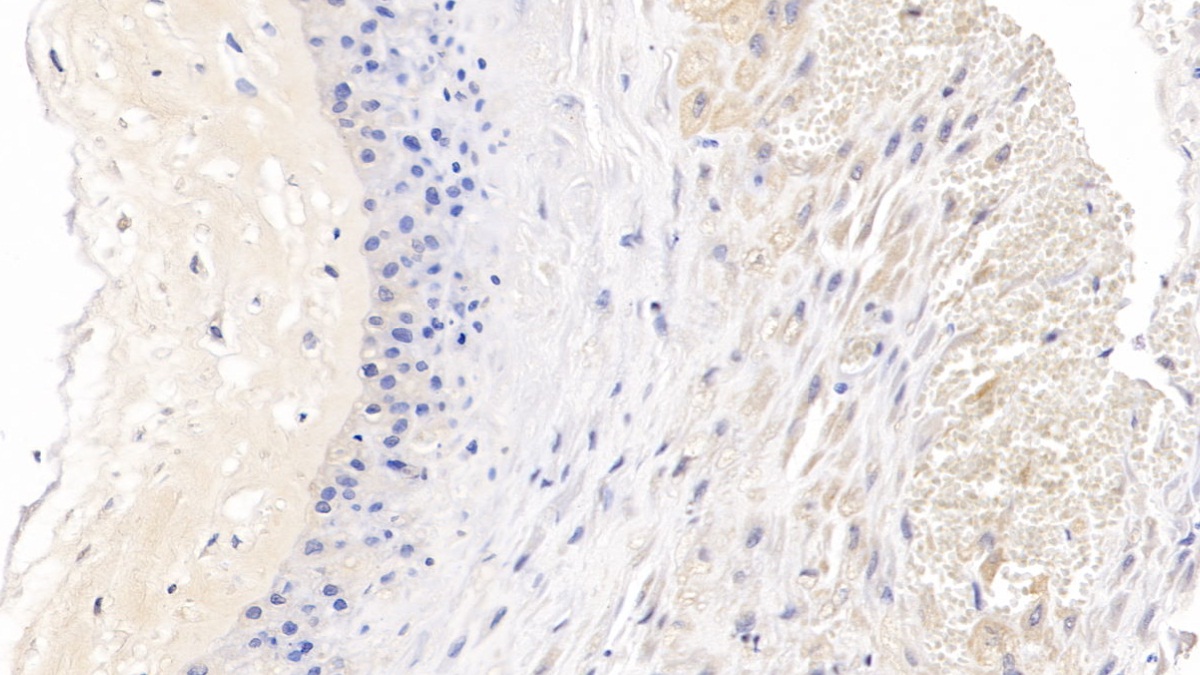 Monoclonal Antibody to C-Ros Oncogene 1, Receptor Tyrosine Kinase (ROS1)