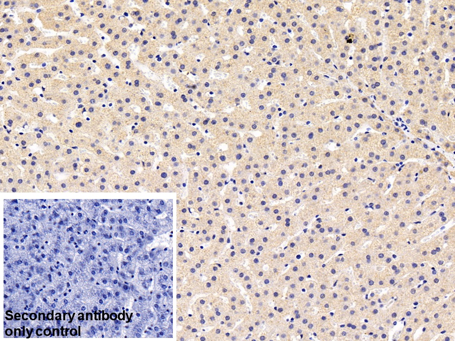 Monoclonal Antibody to Alpha-1-B-Glycoprotein (a1BG)