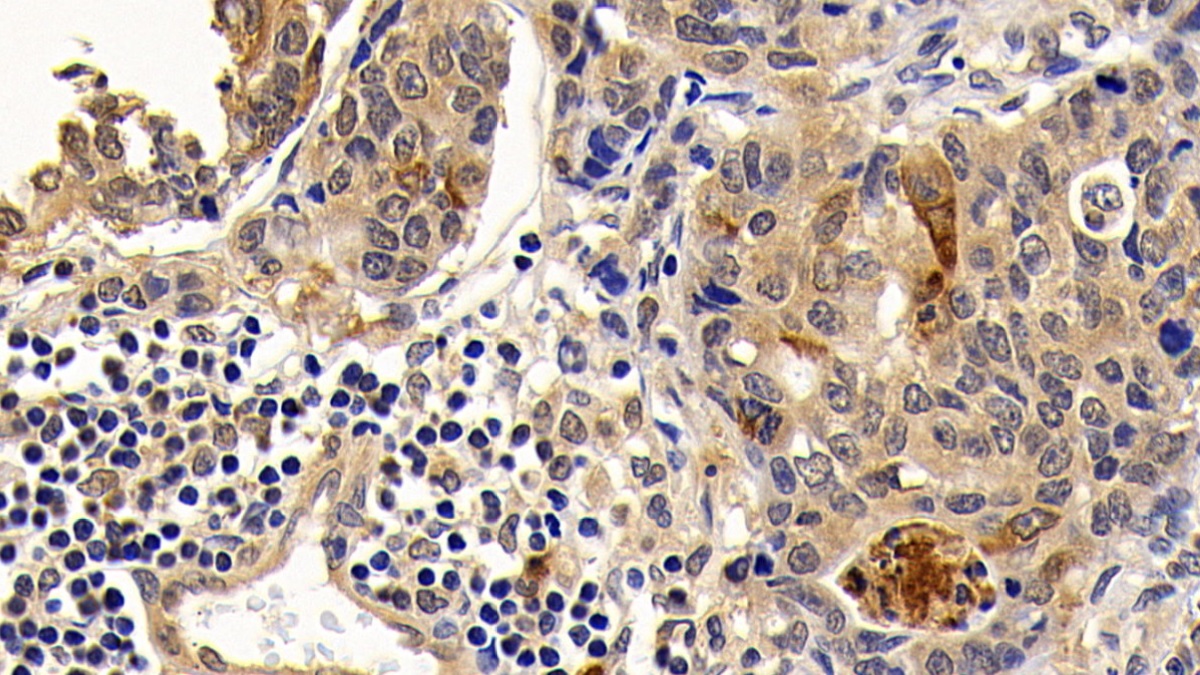 Monoclonal Antibody to B-Cell CLL/Lymphoma 2 Like Protein (Bcl2L)