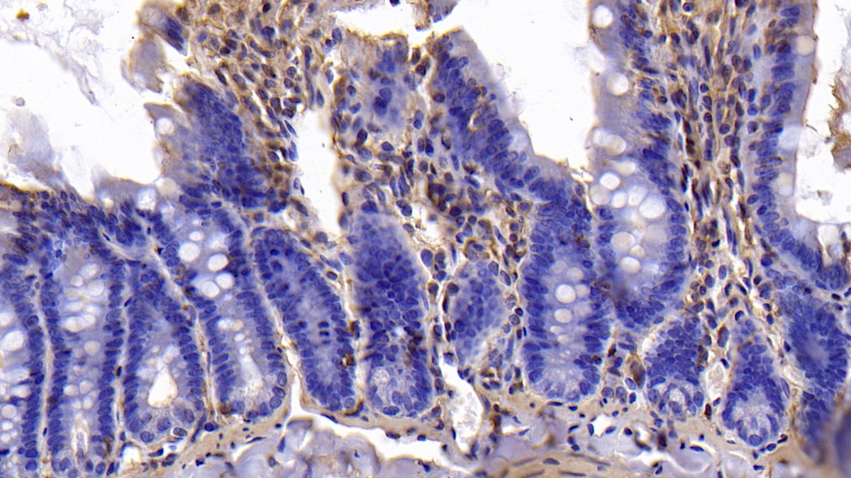 Monoclonal Antibody to B-Cell CLL/Lymphoma 2 Like Protein (Bcl2L)