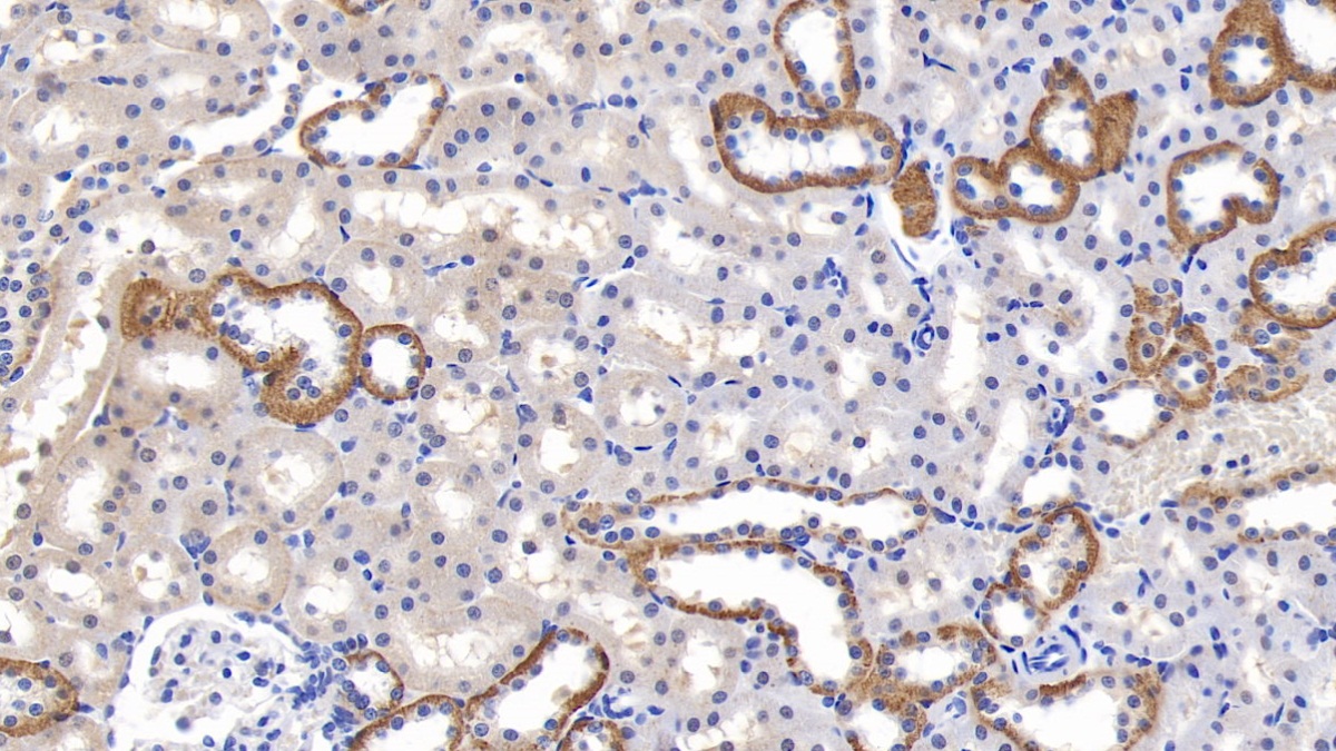 Monoclonal Antibody to Receptor Interacting Serine Threonine Kinase 3 (RIPK3)