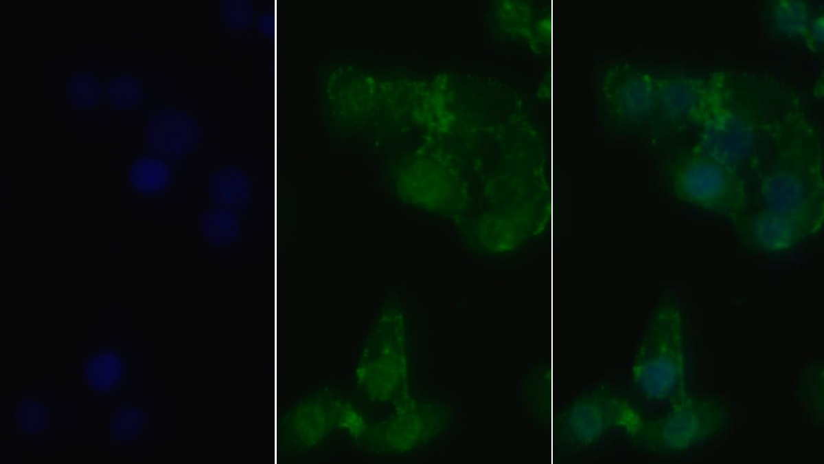 Monoclonal Antibody to Receptor Interacting Serine Threonine Kinase 1 (RIPK1)