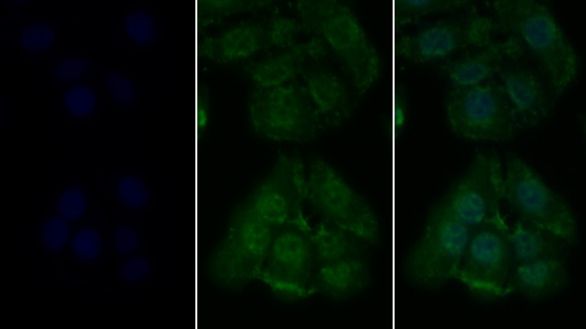 Monoclonal Antibody to Receptor Interacting Serine Threonine Kinase 1 (RIPK1)