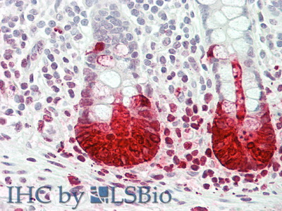 Monoclonal Antibody to Regenerating Islet Derived Protein 3 Alpha (REG3a)