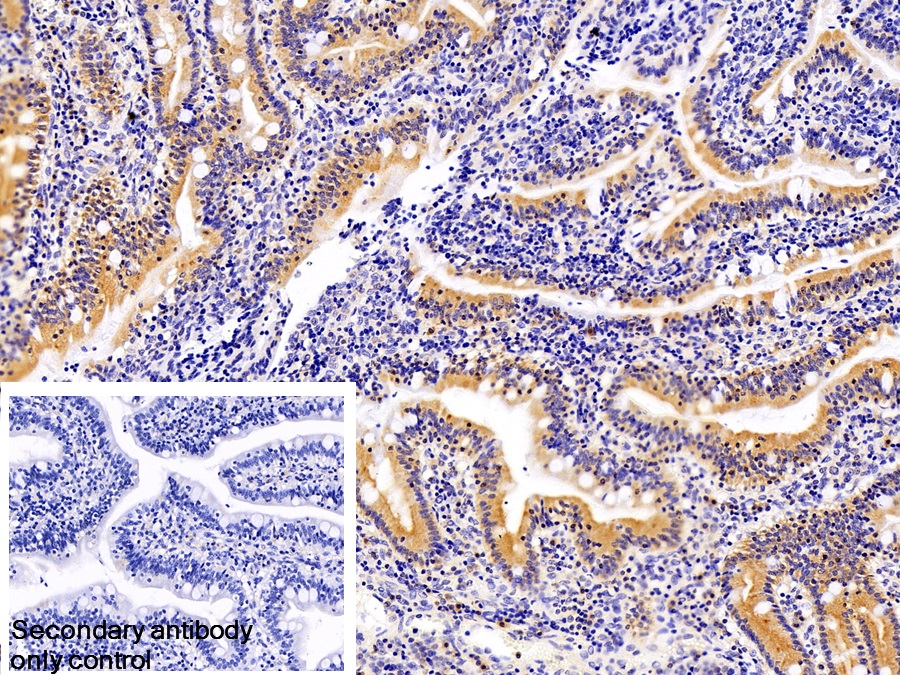 Monoclonal Antibody to Regenerating Islet Derived Protein 3 Gamma (REG3g)