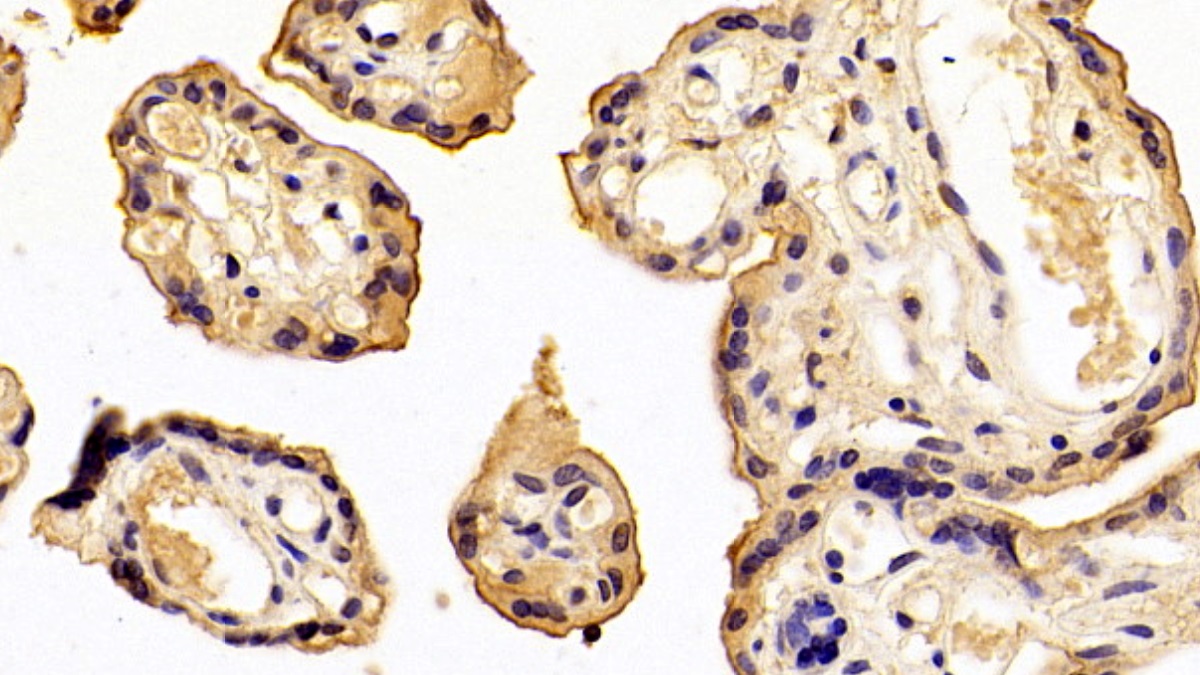 Monoclonal Antibody to Annexin A4 (ANXA4)