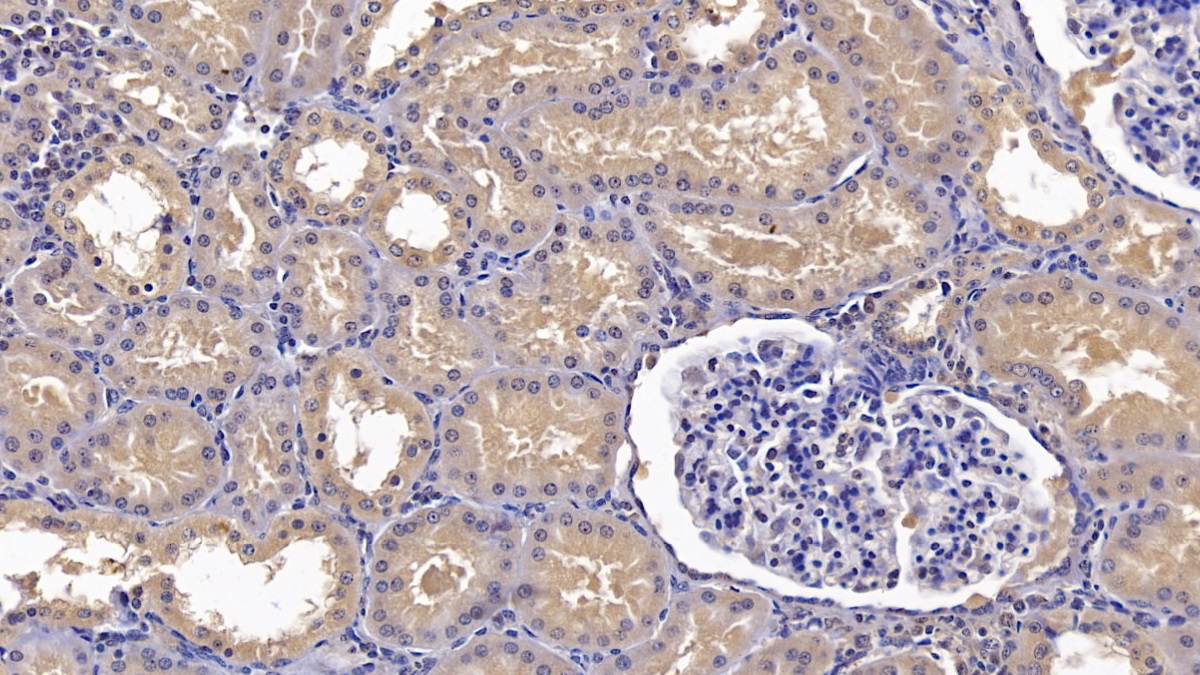 Monoclonal Antibody to Annexin A3 (ANXA3)