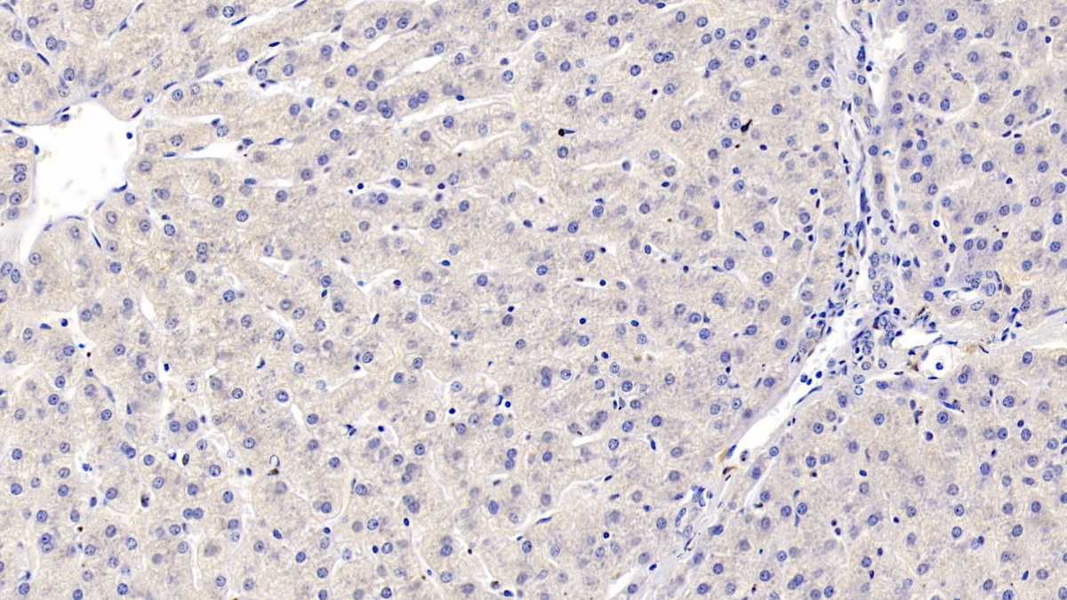 Monoclonal Antibody to Annexin A3 (ANXA3)