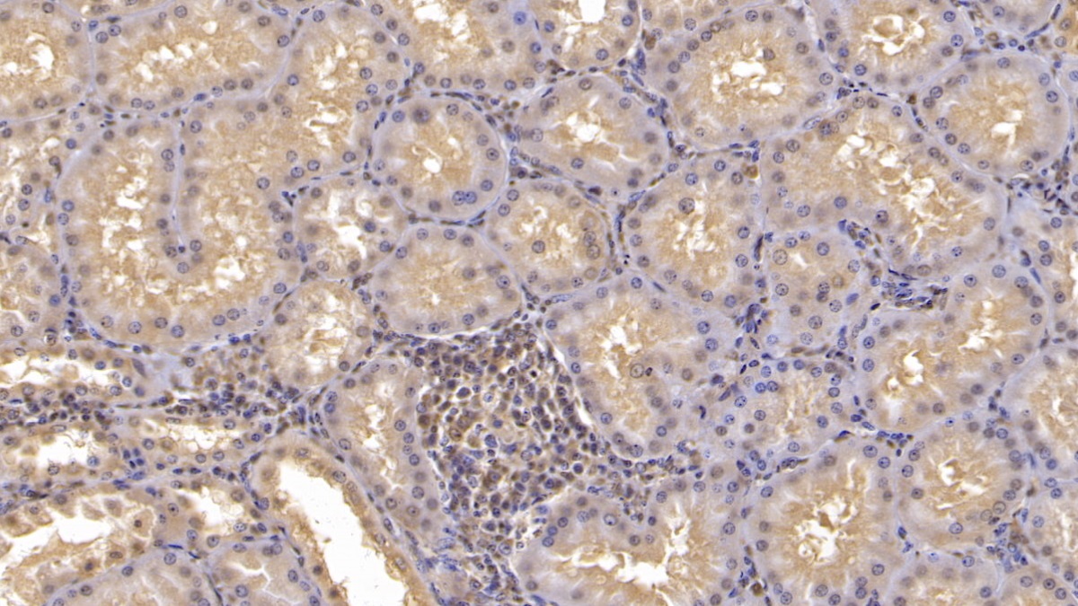 Monoclonal Antibody to Annexin A3 (ANXA3)