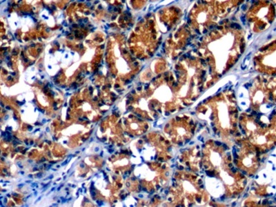 Monoclonal Antibody to Annexin A1 (ANXA1)