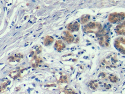 Monoclonal Antibody to Annexin A1 (ANXA1)