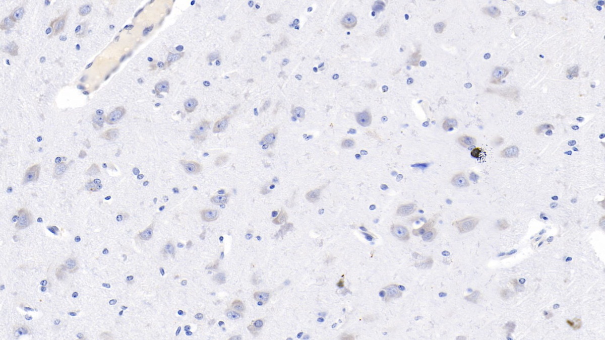 Monoclonal Antibody to Glutamate Receptor, Ionotropic, N-Methyl-D-Aspartate 2B (GRIN2B)