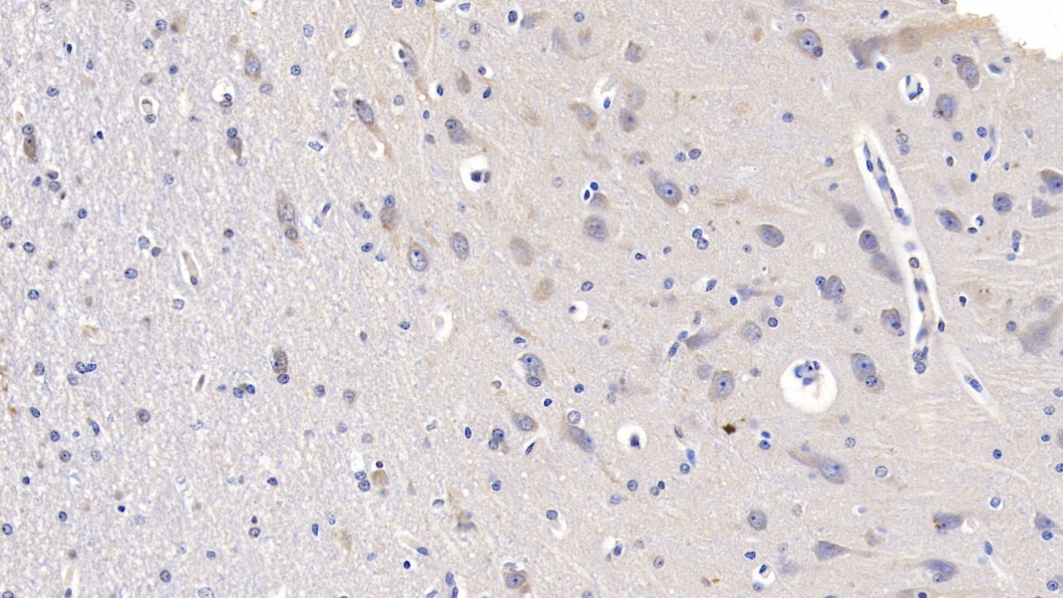 Monoclonal Antibody to Glutamate Receptor, Ionotropic, N-Methyl-D-Aspartate 2B (GRIN2B)