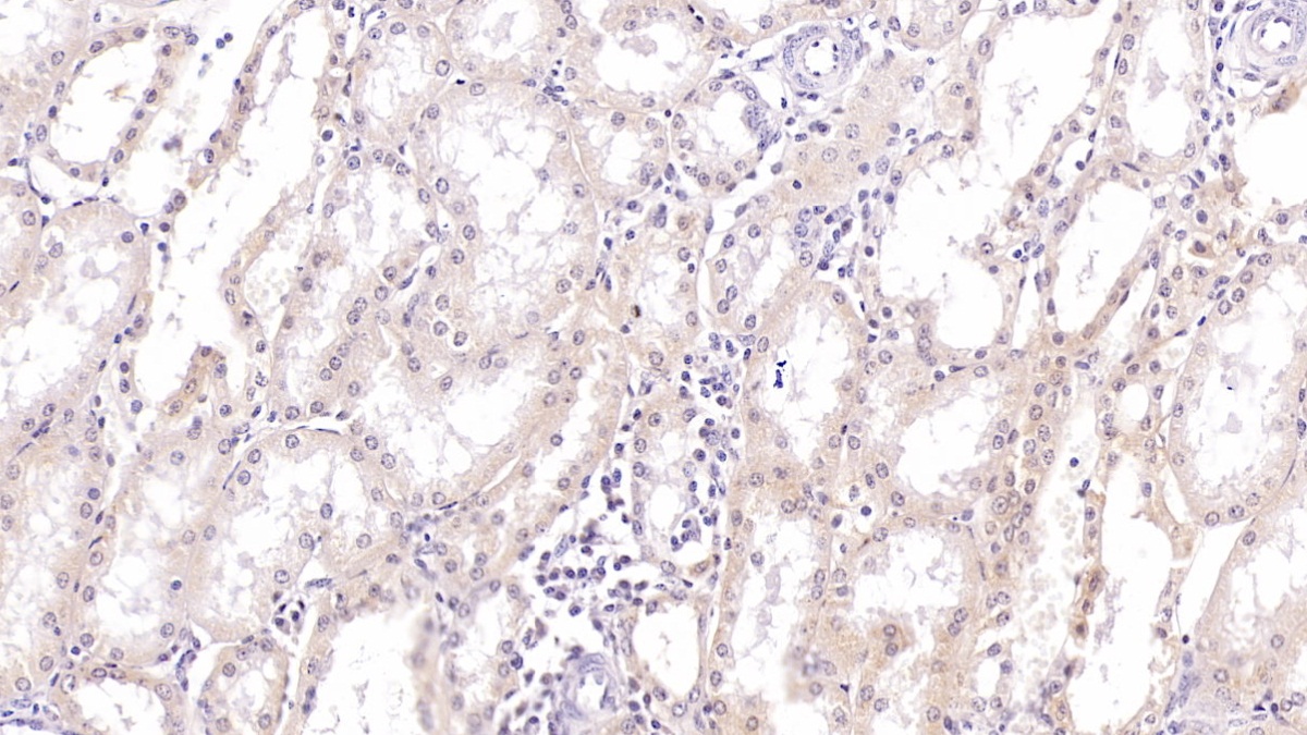 Monoclonal Antibody to Sirtuin 3 (SIRT3)