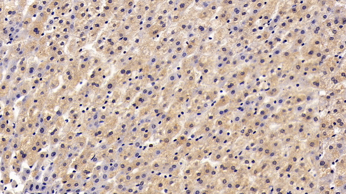 Monoclonal Antibody to Anthrax Toxin Receptor 2 (ANTXR2)