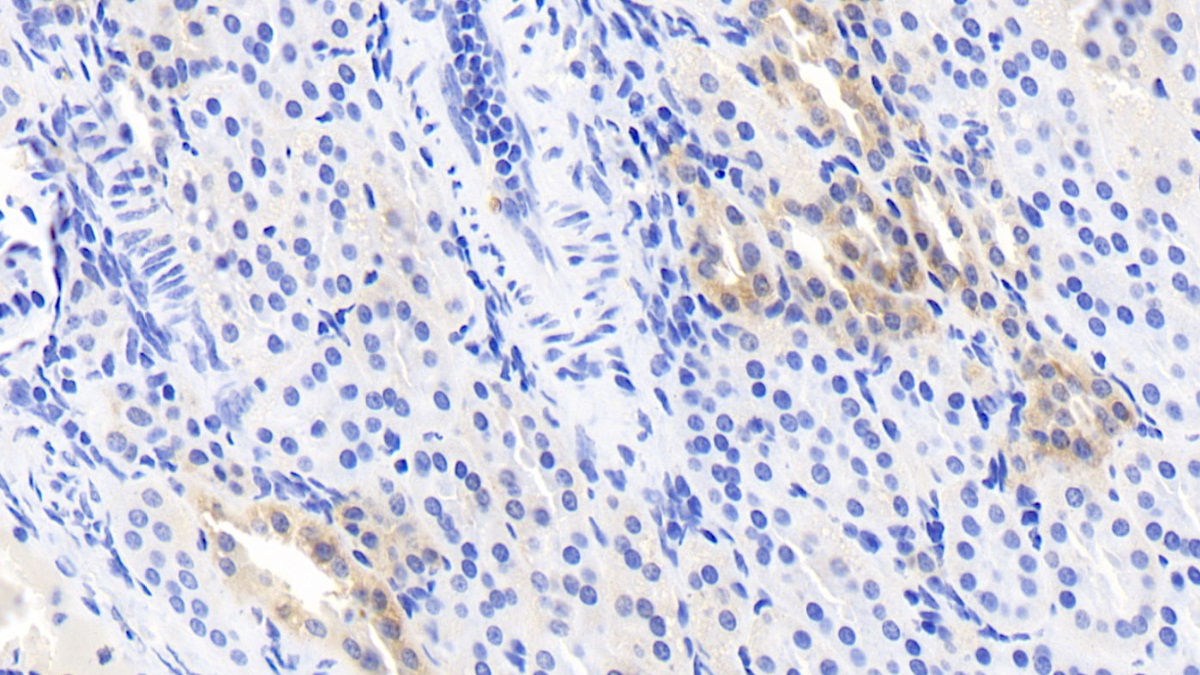 Monoclonal Antibody to Crystallin Lambda 1 (CRYl1)