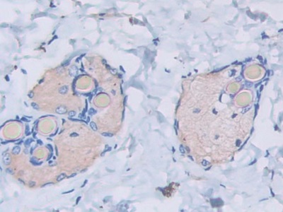 Monoclonal Antibody to Heat Shock Protein Beta 6 (HSPb6)